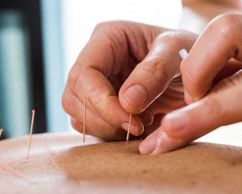 Acupuncture-hero-1.jpg